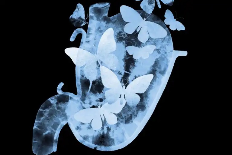 mariposas-estomago-cautiva
