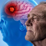 El doctor Francisco Lopera y un nuevo camino para tratar el alzhéimer