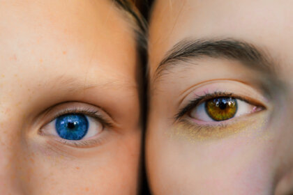 dos-chicas-color-ojos-diferente-420x280